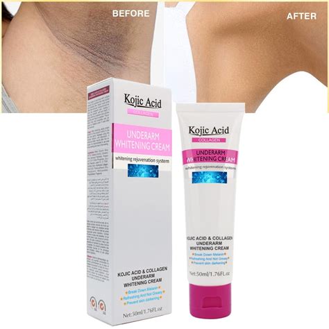 50ml Kojic Acid Women Armpit Whitening Cream – TLSkinCare.Net