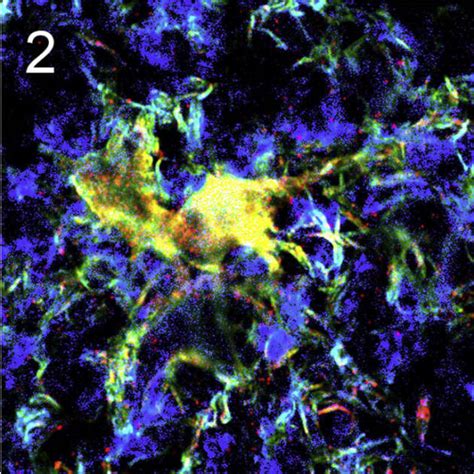 Research in the News: Researchers make exciting discoveries in non-excitable cells