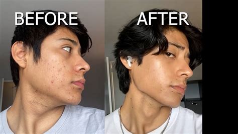 HOW TO GET A SHARP JAWLINE - Top 3 methods no one is talking about ...