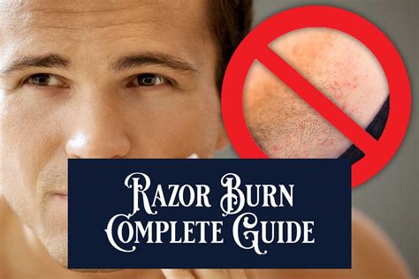 The Complete Guide to Avoid and Treat Razor Burn - Artisan's Republic