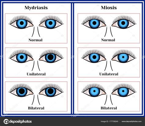 Miosis Y Midriasis