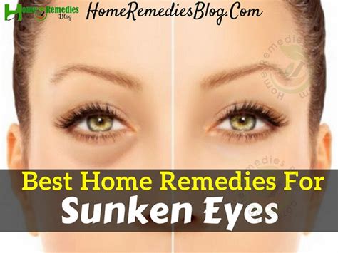 10 Best Home Remedies To Get Rid Of Sunken Eyes - Home Remedies Blog