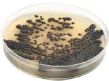 Black Mold Test ..........Do Home Test Kits Work?