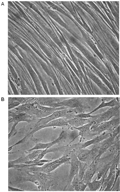 Morphology of isolated normal and tumor-derived fibrobl | Open-i