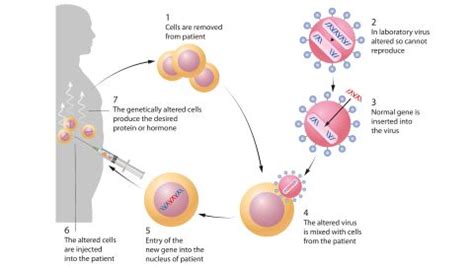 Gene therapy: What is it and how does it work? | Live Science