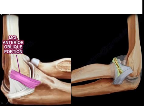 Anatomy of the Ligaments of Elbow — OrthopaedicPrinciples.com