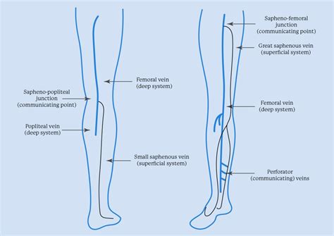 A Diagram of Leg Veins: Leg Vein Anatomy | Legacy Vein Clinic