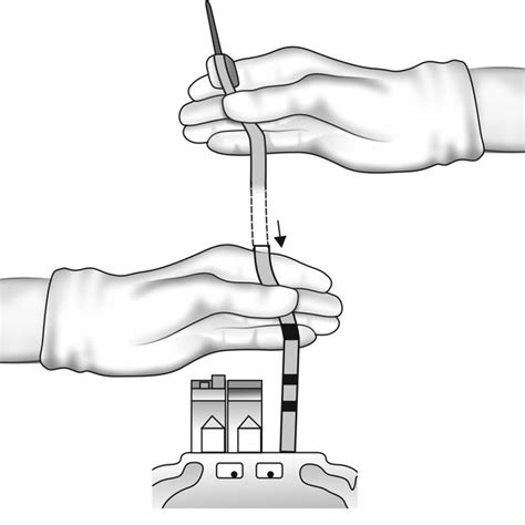 1A Umbilical cord blood collection procedure. Double-clamp the ...