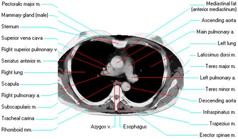 Normal Lung Anatomy