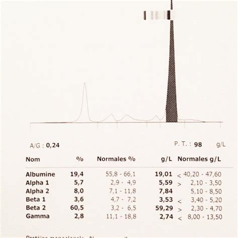 Serum protein electrophoresis. | Download Scientific Diagram