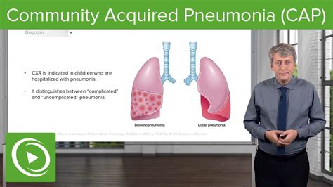 Community Acquired Pneumonia (CAP) – Pediatrics | Lecturio - YouTube