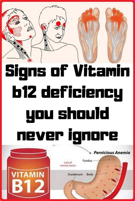 Vitamin B12 Deficiency Diagnosis Code at Samuel Combs blog