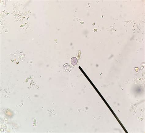 Cystoisospora suis - DocCheck