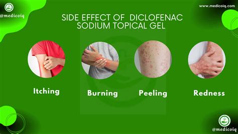 What Is Diclofenac Sodium Topical Gel Used For?