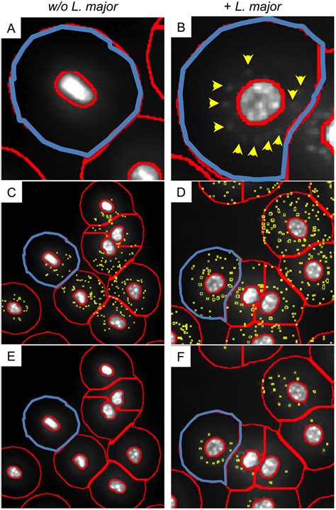 Detection of intracellular parasites within the ring mask. Macrophages... | Download Scientific ...