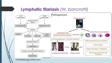 Lymphatic Filariasis - Pictures