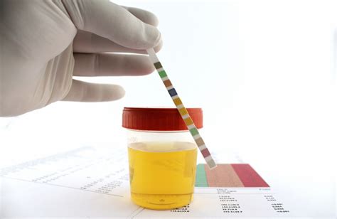 Urine Culture Test: Procedure, Symptoms, and More | MaxinHealth - Blog