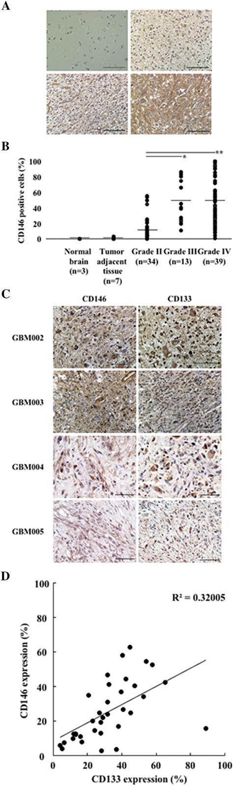 Immunohistochemical analysis of CD146 in glioma tissues. a CD146... | Download Scientific Diagram