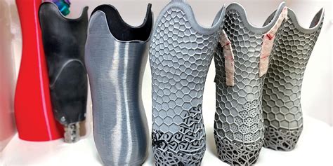 Defining “Definitive”: 3D-printed Lower-limb Sockets Meet the Challenge - The O&P EDGE Magazine