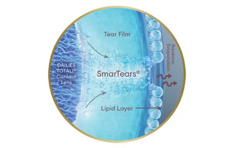 Dailies TOTAL1® Lens Parameters and Fitting Guide | Alcon