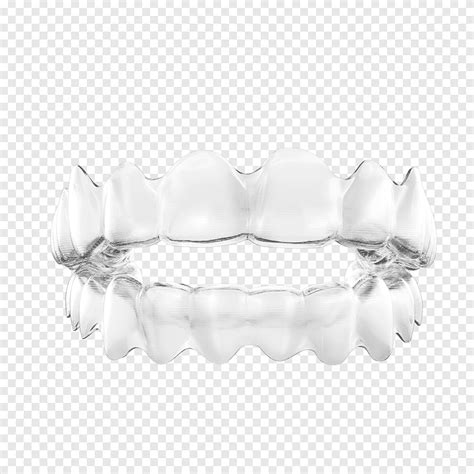 Clear aligners Orthodontics Dental braces Tooth Dentistry, creative plans for dental treatment ...