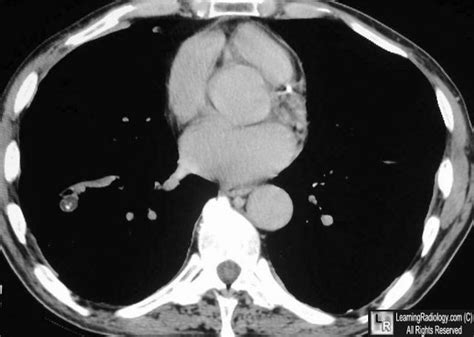 Case of the Week (37 of 131)