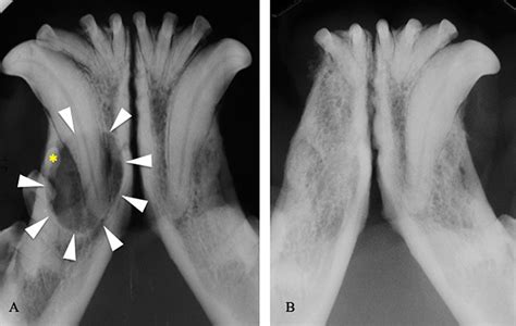 Frontiers | A Clinical, Radiographic and Histological Study of ...