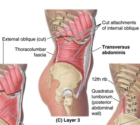 Image - Transversus abdominis.png | RANZCRPart1 Wiki | FANDOM powered ...