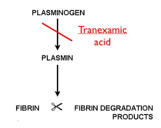 TXA in Trauma — Maimonides Emergency Medicine Residency