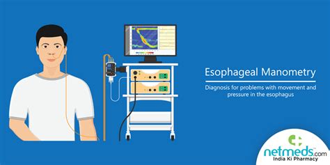 Esophageal Manometry Test: Procedure, Risks And Results