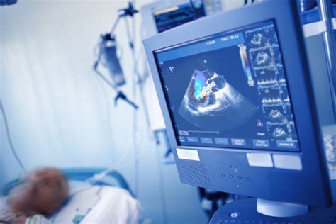 Heart Ultrasound Scans - What to Expect - Heart Health