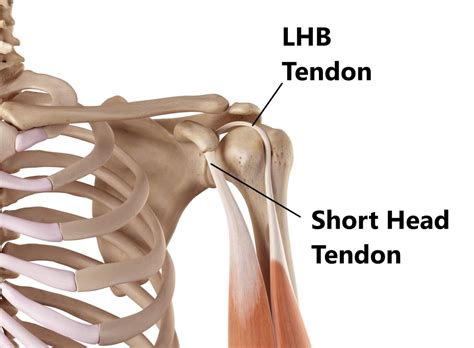 Biceps Tendon Anatomy Shoulder : Bicep Tendon Sprain Front Shoulder ...