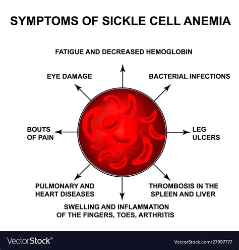 Symptoms sickle cell anemia world sickle cell Vector Image