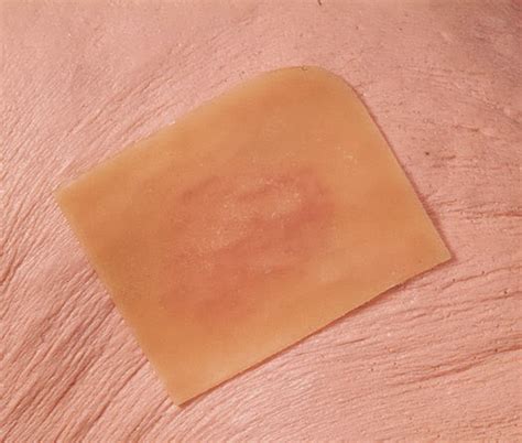 Applying a Hydrating Dressing (Hydrocolloid or Hydrogel) ~ Nursing