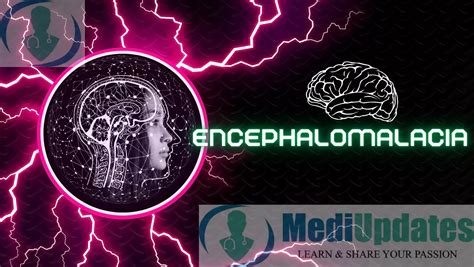 Encephalomalacia: The Brain Eating Monster | MediUpdates