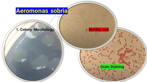 Aeromonas sobria Colony Morphology, Motility and Gram Staining - YouTube