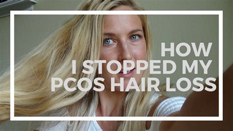 Can You Stop Hair Loss With Pcos - Best Simple Hairstyles for Every Occasion