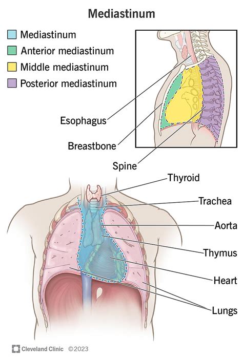 Mediastinal Mass | Mediastinal Tumor Treatment & Surgery | Cleveland Clinic