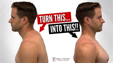 Fix Neck Hump FAST With These Home Exercises! - YouTube