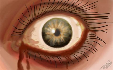 Bleeding Eye by rwcombs on DeviantArt