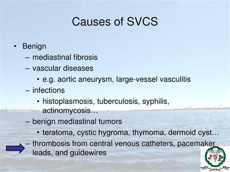 PPT - Management of Superior Vena Cava Syndrome Perspective from vascular surgery PowerPoint ...