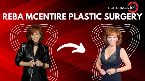 Reba Mcentire Plastic Surgery: Does the Country Star Get a Makeover, Botox, or Fillers?