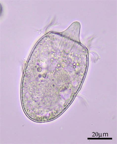 Didinium Under Microscope