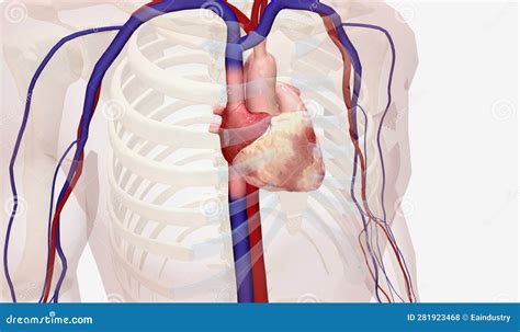 The Implantable Loop Recorder Placement Stock Illustration ...