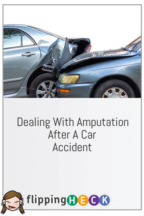 Dealing With Amputation After A Car Accident – Flipping Heck!