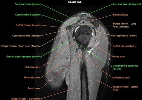 Shoulder: MRI, radiographical, and illustrated anatomical atlas