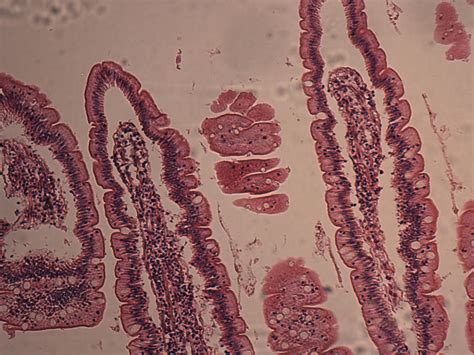 jejunum Histology High Powe.