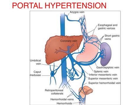 Portal hypertension | PPT