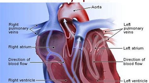 Various types of Heart Diseases, causes and symptoms