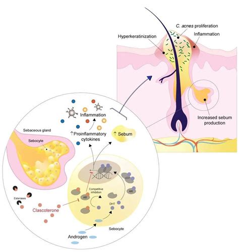 Understanding Winlevi Cream: Uses, Side Effects, and More